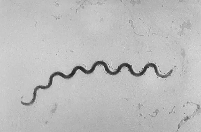 Microscopy image of Syphilis
