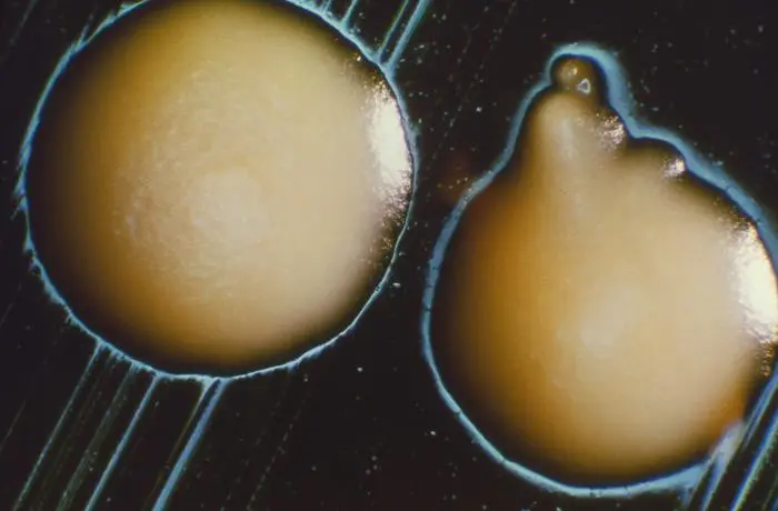 A microcopy image of Candida Albicans