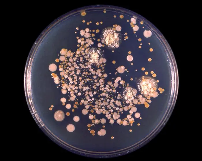  Image of a Petri dish culture of Cryptococcus neoformans