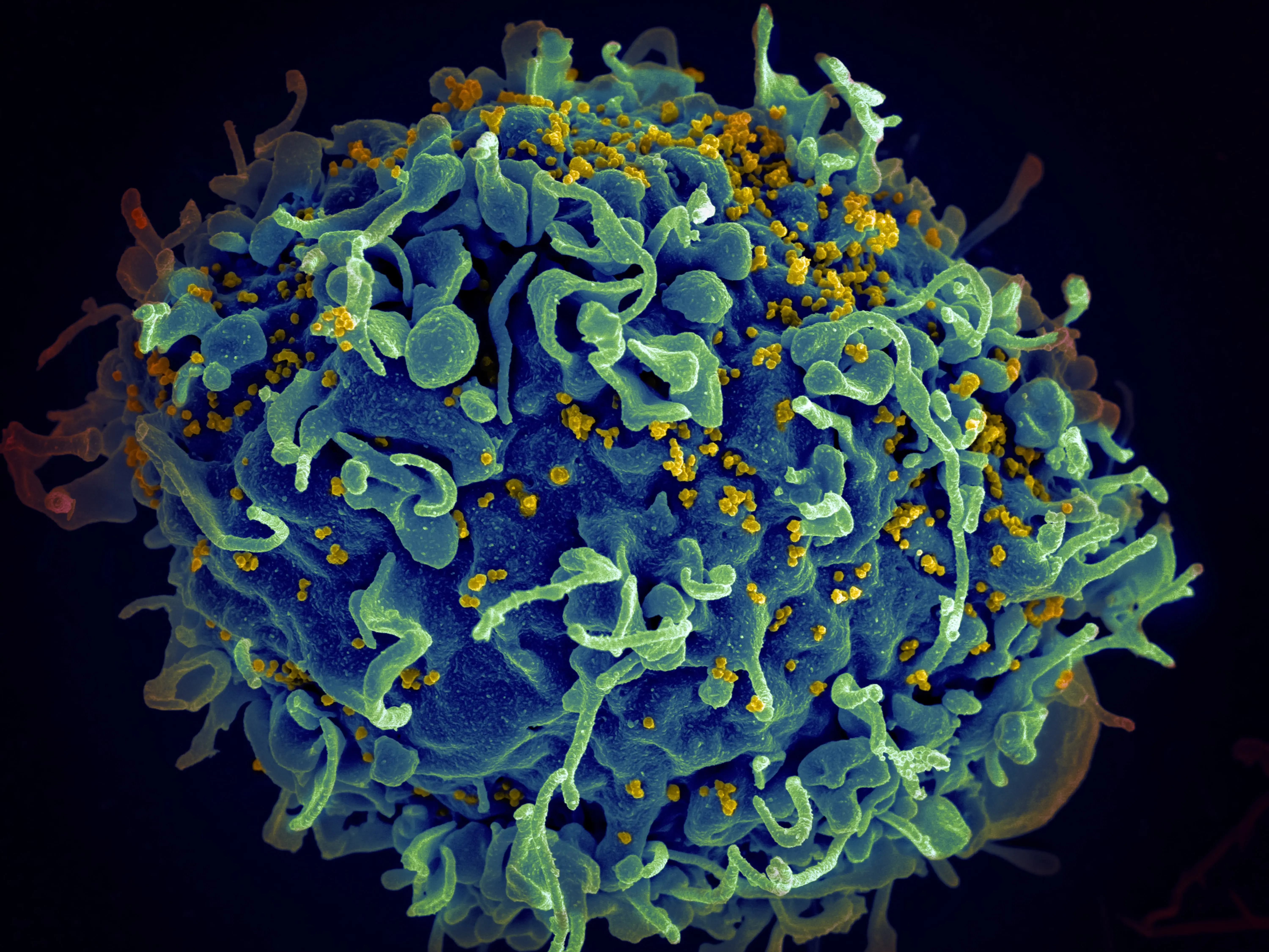An illustration depicting A HIV viral particle