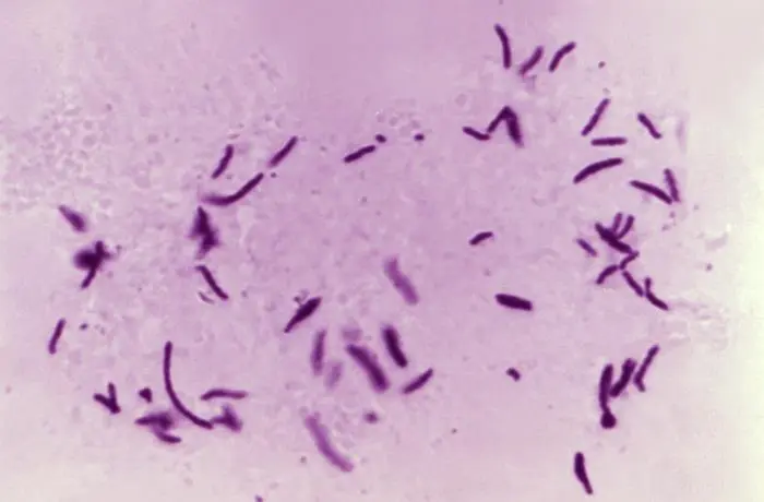 Microscopy image of Tuberculosis